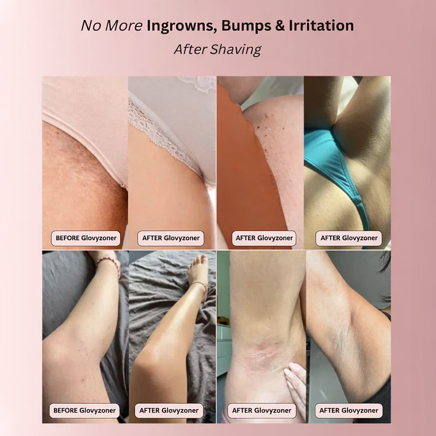 Glovyzoner™ 2-in-1 Women’s Body Shaver